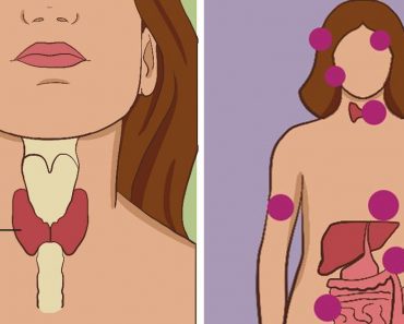 thyroid symptoms