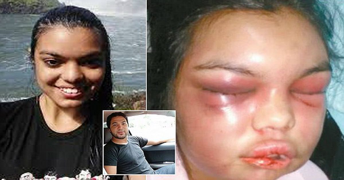 Woman Punched By Her Husband Every Time She Got A ‘Like’ On Facebook