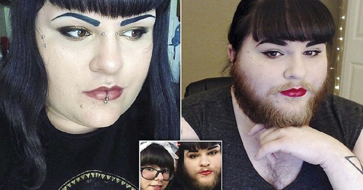 Woman With PCOS Grows A Full Beard After Finding Love With A Model