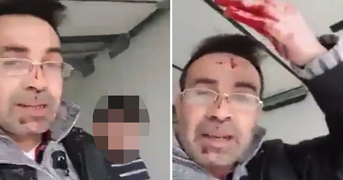 Blood-Splattered Syrian Man Posts Chilling Facebook Live Video