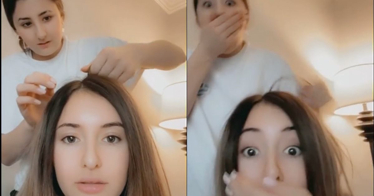 The Latest Viral TikTok Trend Scalp Popping Should Be Added to Your “Do Not Try List”