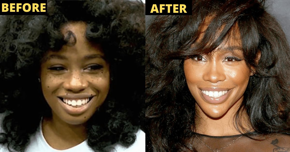 Fans Believe Sza Had Plastic Surgery, Reveal Photos Of Sza Before Surgery